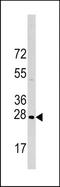 Heat Shock Protein Family B (Small) Member 1 antibody, TA302050, Origene, Western Blot image 