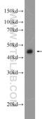 Centrosomal Protein 44 antibody, 24457-1-AP, Proteintech Group, Western Blot image 