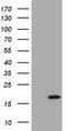 ADP Ribosylation Factor Like GTPase 2 Binding Protein antibody, CF800396, Origene, Western Blot image 