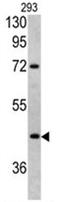 Leucine Rich Alpha-2-Glycoprotein 1 antibody, AP17538PU-N, Origene, Western Blot image 