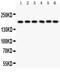 Pappalysin-1 antibody, LS-C357495, Lifespan Biosciences, Western Blot image 