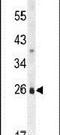 Solute Carrier Family 66 Member 2 antibody, PA5-24353, Invitrogen Antibodies, Western Blot image 