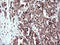 ER Membrane Protein Complex Subunit 8 antibody, LS-C338365, Lifespan Biosciences, Immunohistochemistry paraffin image 