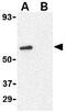 CD294 antibody, GTX31303, GeneTex, Western Blot image 