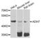 Alcohol Dehydrogenase 7 (Class IV), Mu Or Sigma Polypeptide antibody, LS-C409420, Lifespan Biosciences, Western Blot image 