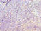 Death Inducer-Obliterator 1 antibody, LS-C380090, Lifespan Biosciences, Immunohistochemistry paraffin image 