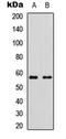 Cytochrome P450 11B2, mitochondrial antibody, LS-C354331, Lifespan Biosciences, Western Blot image 