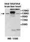Arf-GAP with GTPase, ANK repeat and PH domain-containing protein 2 antibody, orb77510, Biorbyt, Western Blot image 