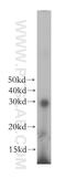 Deoxycytidine kinase antibody, 17758-1-AP, Proteintech Group, Western Blot image 