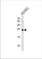 Casein kinase II subunit beta antibody, TA302170, Origene, Western Blot image 