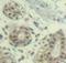 Hdm2 antibody, LS-C335021, Lifespan Biosciences, Immunohistochemistry paraffin image 