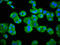 G Protein-Coupled Receptor Kinase 3 antibody, LS-C674948, Lifespan Biosciences, Immunofluorescence image 