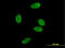 Small heterodimer partner antibody, LS-C198561, Lifespan Biosciences, Immunofluorescence image 