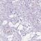 DCC Netrin 1 Receptor antibody, HPA069552, Atlas Antibodies, Immunohistochemistry frozen image 