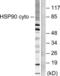 Heat shock protein HSP 90-alpha antibody, LS-B7606, Lifespan Biosciences, Western Blot image 