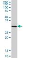 Sideroflexin 1 antibody, H00094081-B01P, Novus Biologicals, Western Blot image 