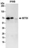 SET Domain Containing 3, Actin Histidine Methyltransferase antibody, NBP2-32137, Novus Biologicals, Immunoprecipitation image 