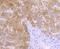 10-FTHFDH antibody, A04615, Boster Biological Technology, Immunohistochemistry paraffin image 