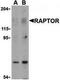 Regulatory Associated Protein Of MTOR Complex 1 antibody, TA319977, Origene, Western Blot image 