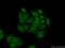 Histone-lysine N-methyltransferase SETD7 antibody, 24840-1-AP, Proteintech Group, Immunofluorescence image 