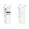 Peroxisomal carnitine O-octanoyltransferase antibody, PA5-53985, Invitrogen Antibodies, Western Blot image 