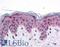 PR/SET Domain 16 antibody, LS-B4625, Lifespan Biosciences, Immunohistochemistry paraffin image 