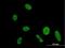 Disco-interacting protein 2 homolog A antibody, H00023181-B01P, Novus Biologicals, Immunocytochemistry image 