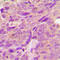 Protein Kinase AMP-Activated Non-Catalytic Subunit Beta 1 antibody, LS-C358838, Lifespan Biosciences, Immunohistochemistry paraffin image 