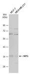 N-Methylpurine DNA Glycosylase antibody, GTX101916, GeneTex, Western Blot image 