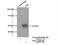 Mitogen-Activated Protein Kinase 8 antibody, 24164-1-AP, Proteintech Group, Immunoprecipitation image 