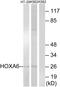 Homeobox A6 antibody, GTX87454, GeneTex, Western Blot image 