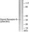 Opioid Receptor Delta 1 antibody, LS-C199347, Lifespan Biosciences, Western Blot image 