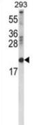 Retinol-binding protein 2 antibody, abx034421, Abbexa, Western Blot image 