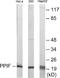 Peptidylprolyl Isomerase F antibody, EKC1705, Boster Biological Technology, Western Blot image 