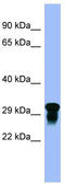 V-Set Immunoregulatory Receptor antibody, TA338488, Origene, Western Blot image 