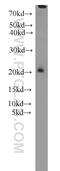 Mitochondrial import inner membrane translocase subunit Tim17-B antibody, 11062-1-AP, Proteintech Group, Western Blot image 