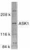 Mitogen-Activated Protein Kinase Kinase Kinase 5 antibody, LS-C271, Lifespan Biosciences, Western Blot image 