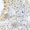 Dynein light chain 1, axonemal antibody, A8267, ABclonal Technology, Immunohistochemistry paraffin image 