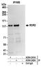 Receptor Tyrosine Kinase Like Orphan Receptor 2 antibody, A304-242A, Bethyl Labs, Immunoprecipitation image 