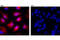 Vimentin antibody, 7675S, Cell Signaling Technology, Immunocytochemistry image 