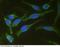 CD44 antibody, 12211-MM02, Sino Biological, Immunohistochemistry paraffin image 
