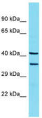 Vesicular integral-membrane protein VIP36 antibody, TA343193, Origene, Western Blot image 
