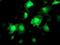 Akt antibody, NBP2-01724, Novus Biologicals, Immunocytochemistry image 