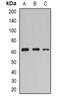Plasminogen Activator, Tissue Type antibody, abx142146, Abbexa, Western Blot image 