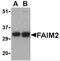 Fas apoptotic inhibitory molecule 2 antibody, 2285, ProSci Inc, Western Blot image 