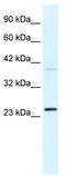 Neuronal Calcium Sensor 1 antibody, TA335627, Origene, Western Blot image 