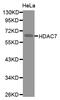 Histone Deacetylase 7 antibody, MBS127709, MyBioSource, Western Blot image 