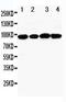 DNA replication licensing factor MCM4 antibody, PA5-79647, Invitrogen Antibodies, Western Blot image 