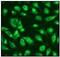 Superoxide Dismutase 1 antibody, ab51254, Abcam, Immunofluorescence image 