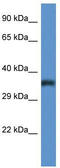 Phosphatidylinositol N-acetylglucosaminyltransferase subunit C antibody, TA343078, Origene, Western Blot image 